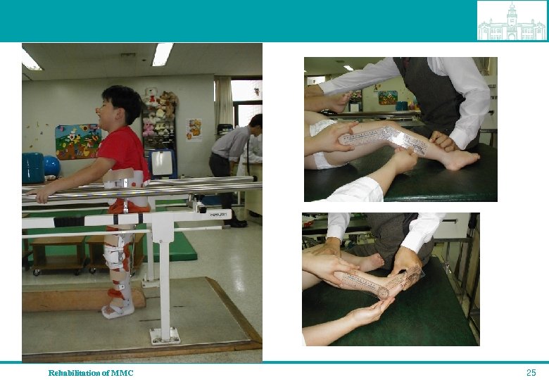 Rehabilitation of MMC 25 