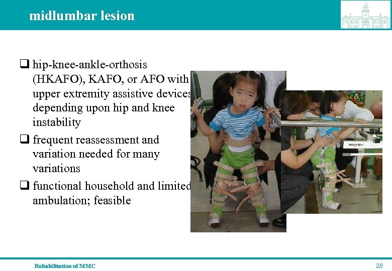 midlumbar lesion q hip-knee-ankle-orthosis (HKAFO), KAFO, or AFO with upper extremity assistive devices depending