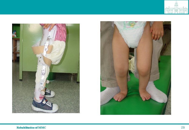 Rehabilitation of MMC 29 