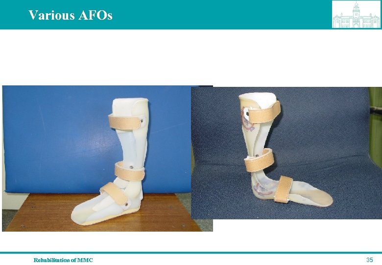Various AFOs Rehabilitation of MMC 35 