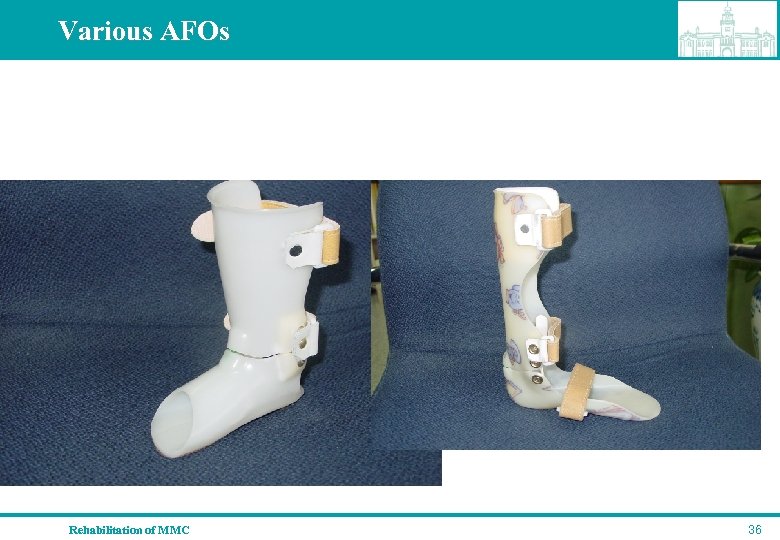 Various AFOs Rehabilitation of MMC 36 