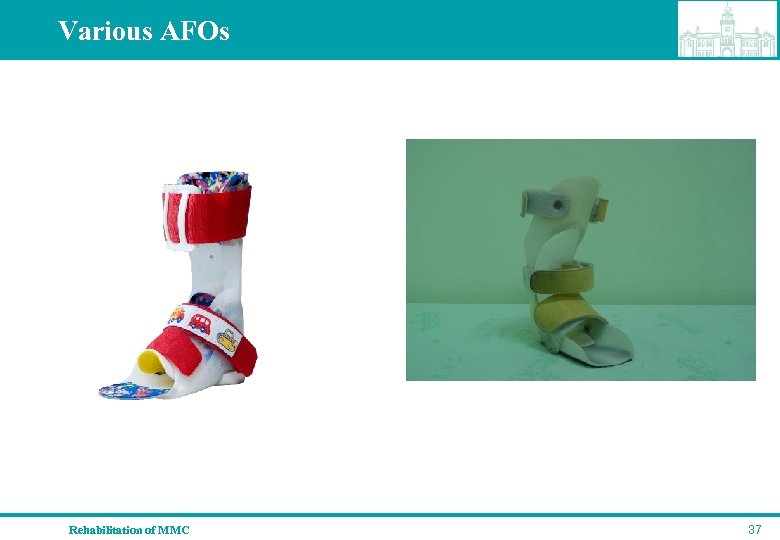 Various AFOs Rehabilitation of MMC 37 