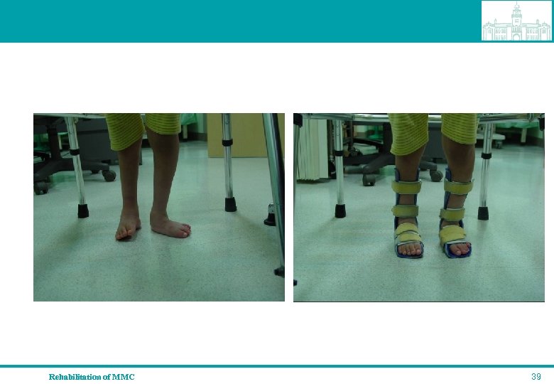 Rehabilitation of MMC 39 