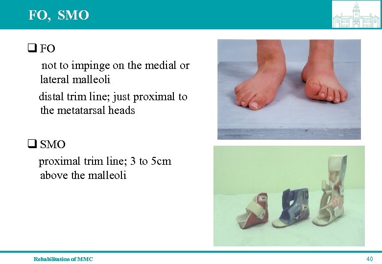 FO, SMO q FO not to impinge on the medial or lateral malleoli distal