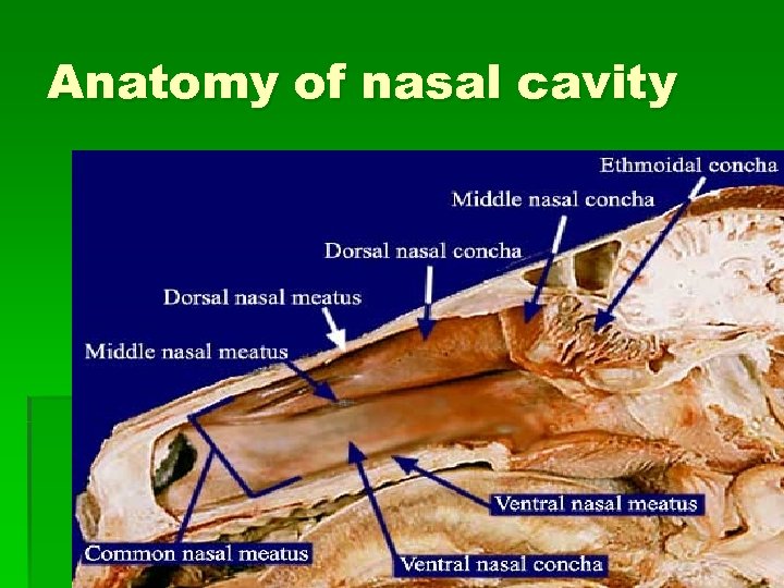 Anatomy of nasal cavity 