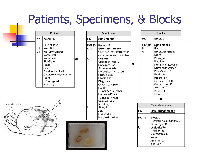Patients, Specimens, & Blocks The Patients, Specimens, Blocks, and Tissue Diagnosis tables all form