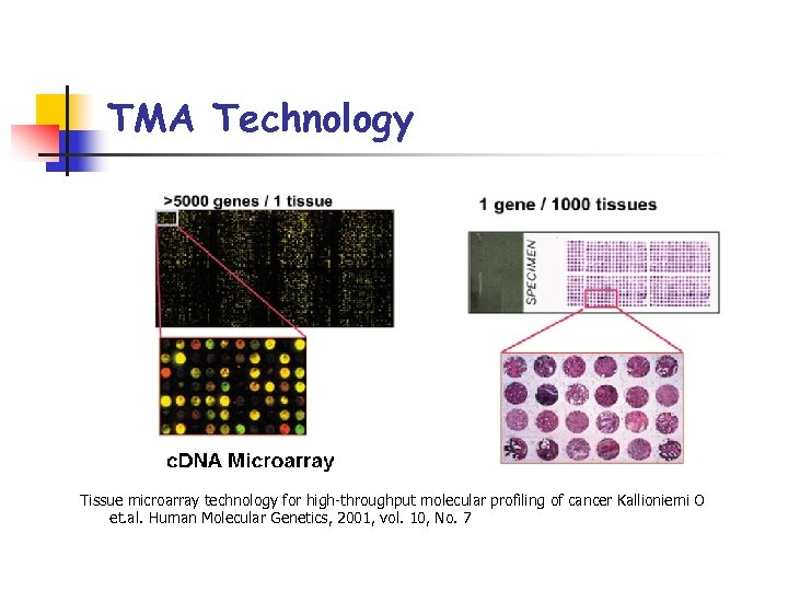 TMA Technology Tissue microarray technology for high-throughput molecular profiling of cancer Kallioniemi O et.