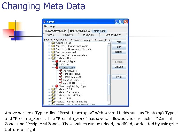 Changing Meta Data Above we see a Type called “Prostate Atrophy” with several fields