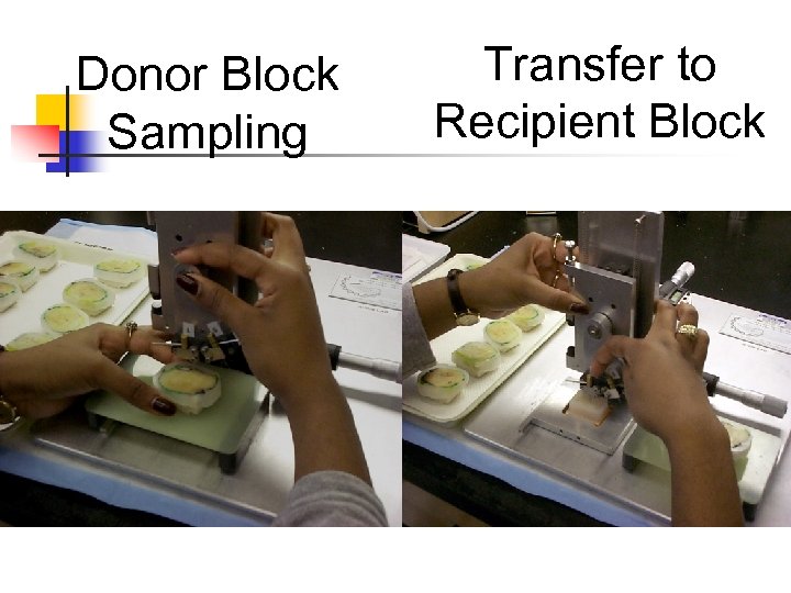 Donor Block Sampling Transfer to Recipient Block 