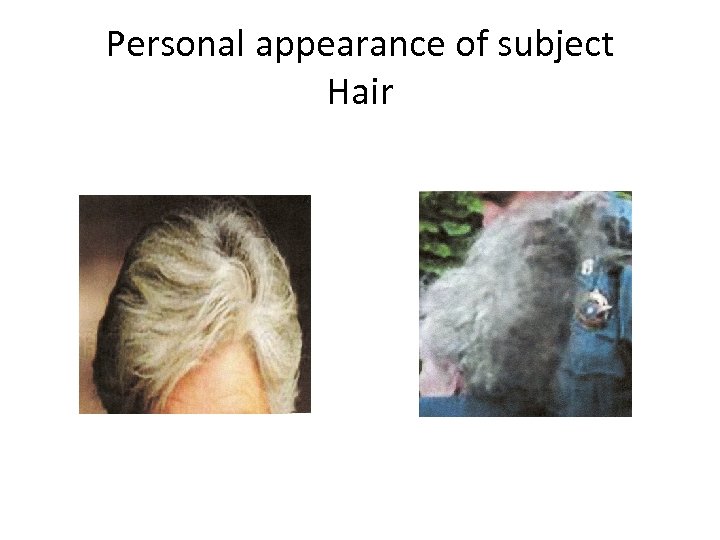 Personal appearance of subject Hair 