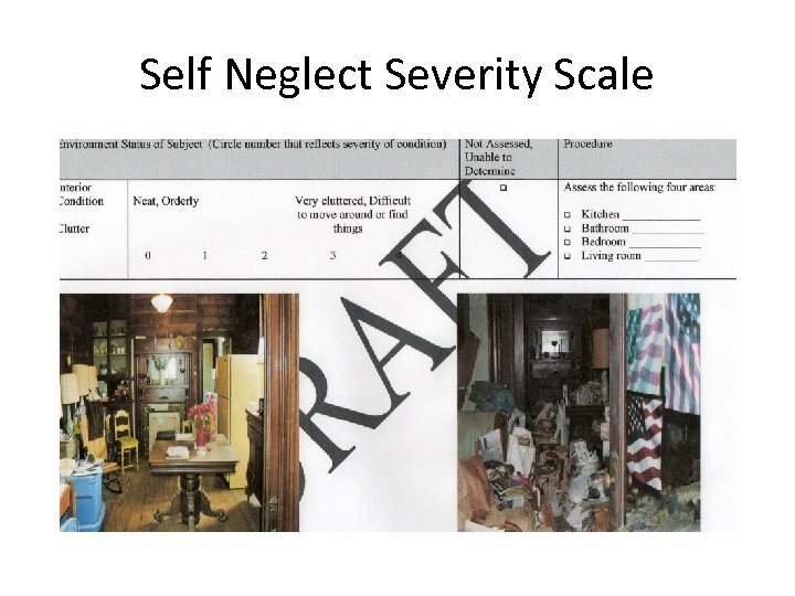 Self Neglect Severity Scale 