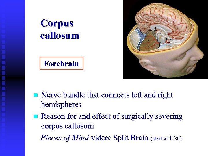 Corpus callosum Forebrain Nerve bundle that connects left and right hemispheres n Reason for