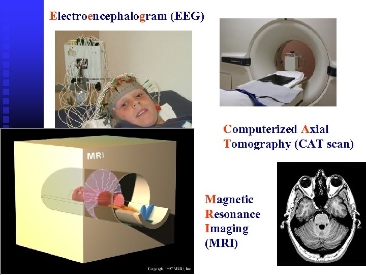 Electroencephalogram (EEG) Computerized Axial Tomography (CAT scan) Magnetic Resonance Imaging (MRI) 