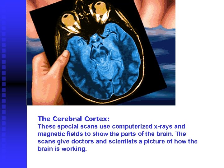  The Cerebral Cortex: These special scans use computerized x-rays and magnetic fields to
