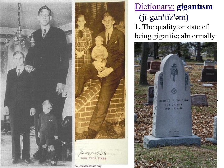 Dictionary: gigantism (jī-găn'tĭz'əm) 1. The quality or state of being gigantic; abnormally large size.