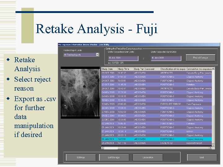 Retake Analysis - Fuji w Retake Analysis w Select reject reason w Export as.