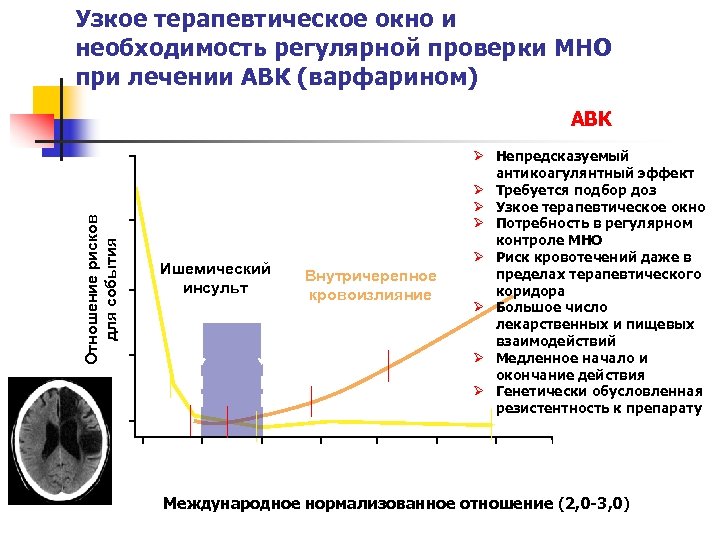 Узкое терапевтическое окно и необходимость регулярной проверки МНО при лечении АВК (варфарином) АВК 20