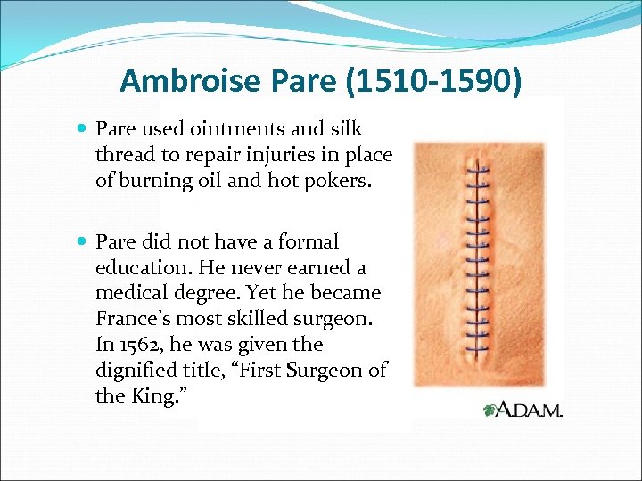 Ambroise Pare (1510 -1590) Pare used ointments and silk thread to repair injuries in