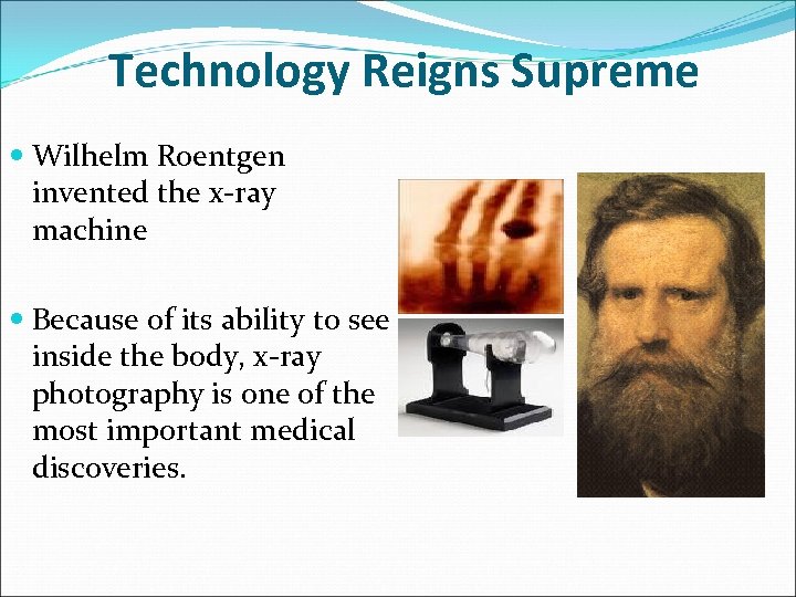 Technology Reigns Supreme Wilhelm Roentgen invented the x-ray machine Because of its ability to