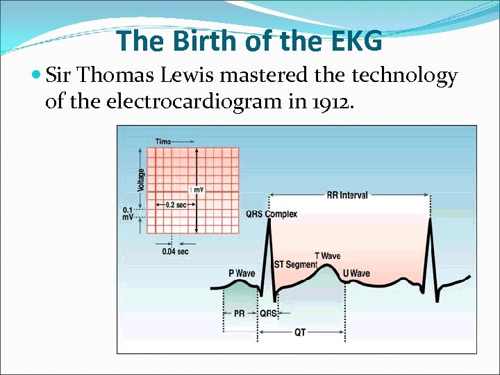 The Birth of the EKG Sir Thomas Lewis mastered the technology of the electrocardiogram