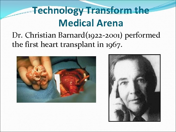 Technology Transform the Medical Arena Dr. Christian Barnard(1922 -2001) performed the first heart transplant