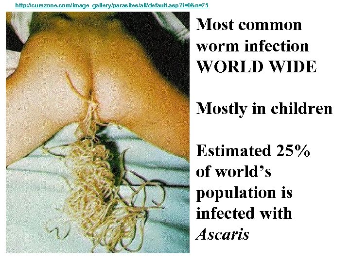 http: //curezone. com/image_gallery/parasites/all/default. asp? i=0&n=75 Most common worm infection WORLD WIDE Mostly in children