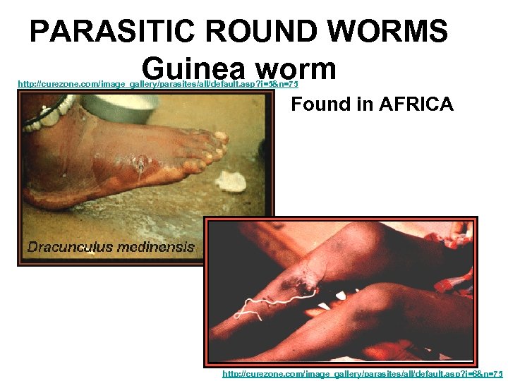 PARASITIC ROUND WORMS Guinea worm http: //curezone. com/image_gallery/parasites/all/default. asp? i=5&n=75 Found in AFRICA http: