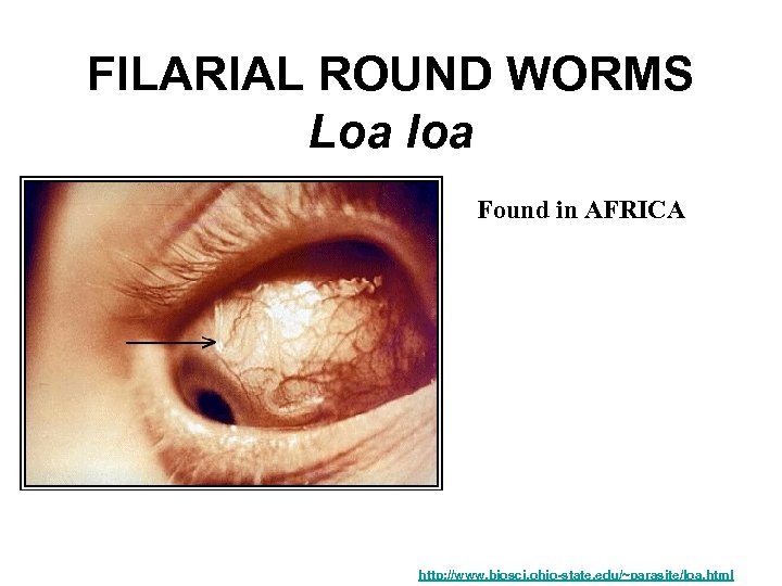 FILARIAL ROUND WORMS Loa loa Found in AFRICA http: //www. biosci. ohio-state. edu/~parasite/loa. html