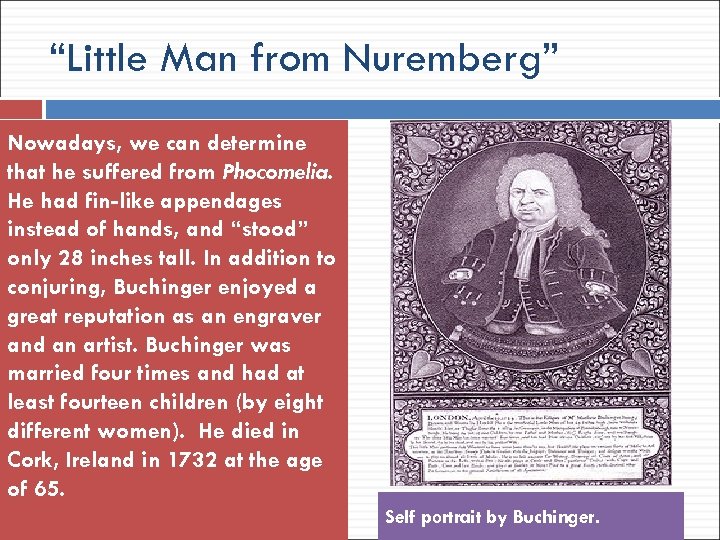 “Little Man from Nuremberg” Nowadays, we can determine that he suffered from Phocomelia. He