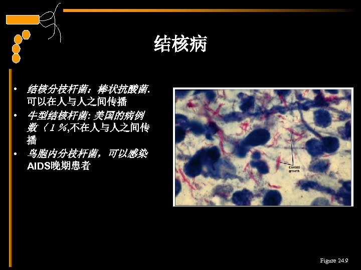 结核病 • 结核分枝杆菌：棒状抗酸菌. 可以在人与人之间传播 • 牛型结核杆菌: 美国的病例 数〈１％, 不在人与人之间传 播 • 鸟胞内分枝杆菌，可以感染 AIDS晚期患者 Figure