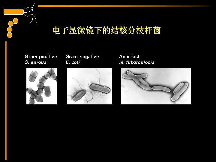 电子显微镜下的结核分枝杆菌 Gram-positive S. aureus Gram-negative E. coli Acid fast M. tuberculosis 