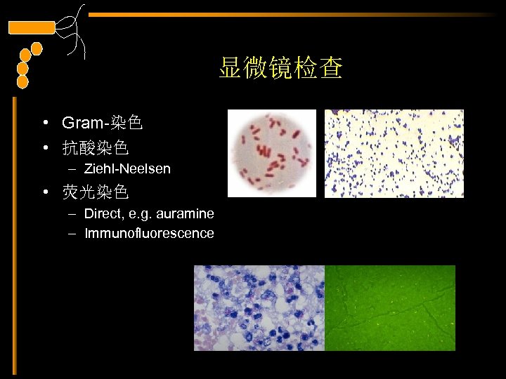 显微镜检查 • Gram-染色 • 抗酸染色 – Ziehl-Neelsen • 荧光染色 – Direct, e. g. auramine