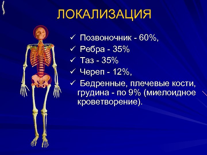 ЛОКАЛИЗАЦИЯ ü ü ü Позвоночник - 60%, Ребра - 35% Таз - 35% Череп
