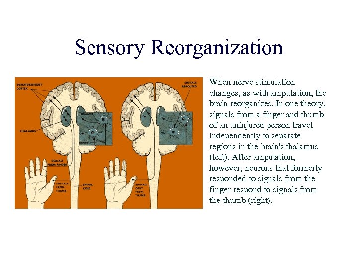 Sensory Reorganization When nerve stimulation changes, as with amputation, the brain reorganizes. In one