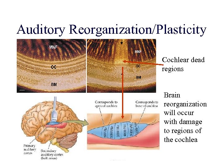 Auditory Reorganization/Plasticity Cochlear dead regions Brain reorganization will occur with damage to regions of