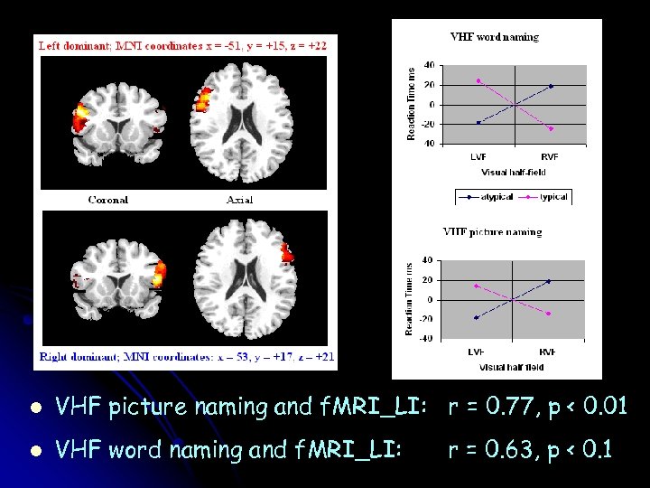 l VHF picture naming and f. MRI_LI: r = 0. 77, p < 0.