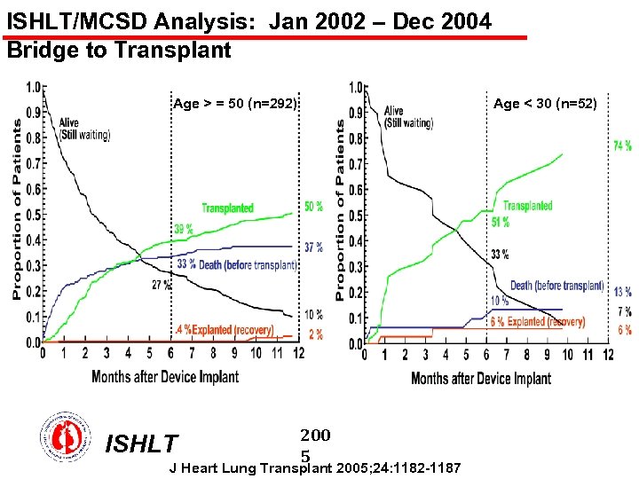ISHLT/MCSD Analysis: Jan 2002 – Dec 2004 Bridge to Transplant Age > = 50