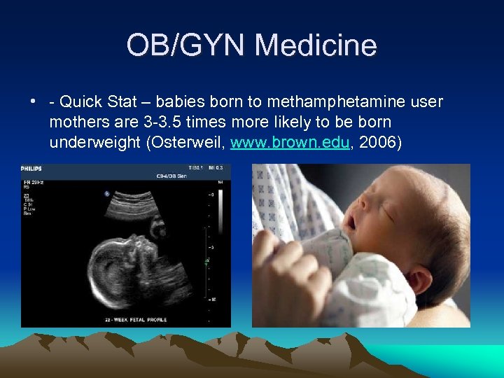 OB/GYN Medicine • - Quick Stat – babies born to methamphetamine user mothers are