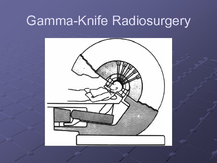 Gamma-Knife Radiosurgery 