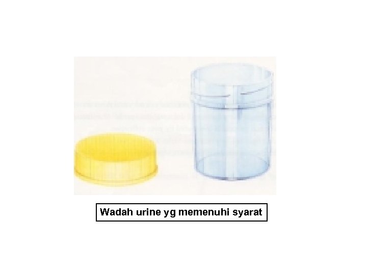 Wadah urine yg memenuhi syarat 