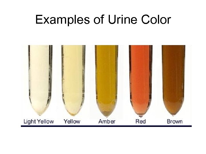 Examples of Urine Color 