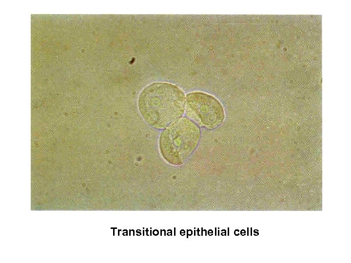 Transitional epithelial cells 
