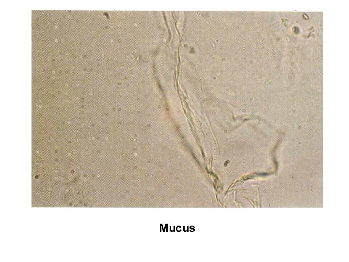 Mucus 