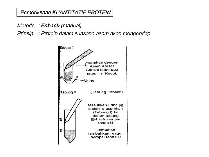 Pemeriksaan KUANTITATIF PROTEIN Metode : Esbach (manual) Prinsip : Protein dalam suasana asam akan