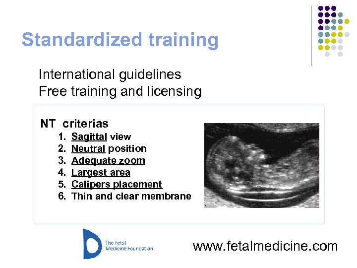 Standardized training International guidelines Free training and licensing NT criterias 1. 2. 3. 4.