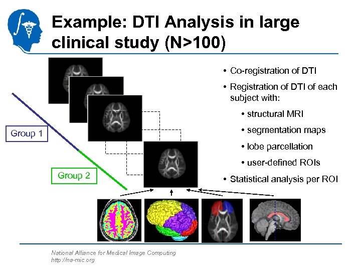 Example: DTI Analysis in large clinical study (N>100) • Co-registration of DTI • Registration