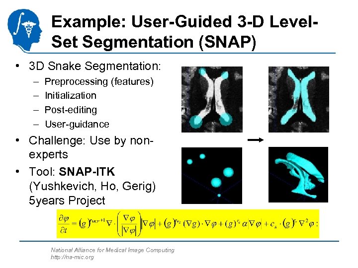 Example: User-Guided 3 -D Level. Set Segmentation (SNAP) • 3 D Snake Segmentation: –