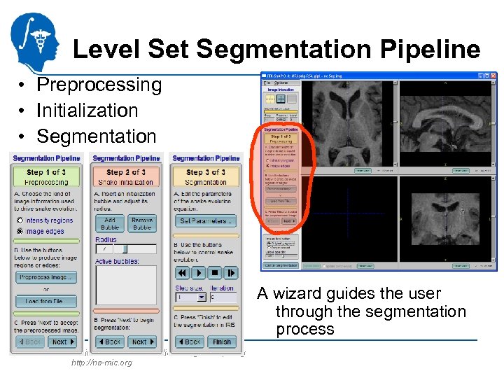 Level Set Segmentation Pipeline • Preprocessing • Initialization • Segmentation A wizard guides the