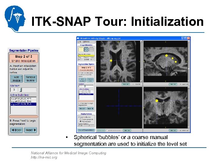 ITK-SNAP Tour: Initialization • Spherical ‘bubbles’ or a coarse manual segmentation are used to