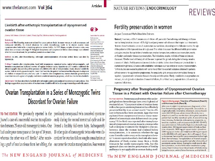 Онкофертильность в журналах с высоким импакт фактором LOGO www. themegallery. com 